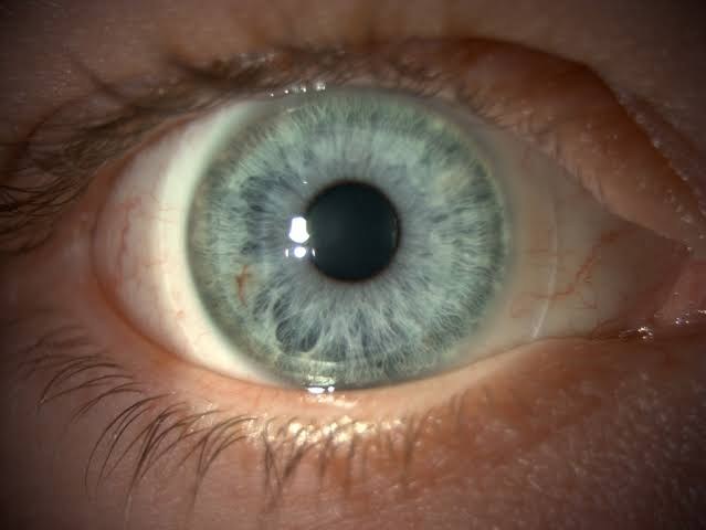 Hybrid Contact Lenses
